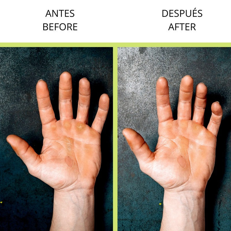 VELITES LIJA CALLOS STONE